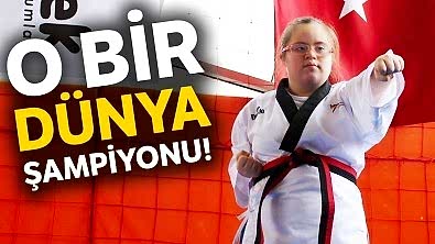 Dawn Sendromlu Dünya Şampiyonumuz